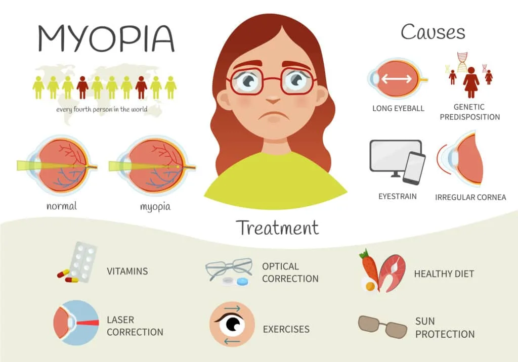 myopia management infographic.